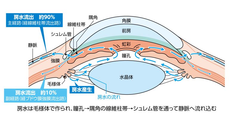 緑内障の原因